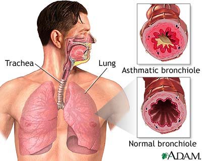 Bronchoscopy